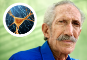 New Angles on Alzheimer's Disease