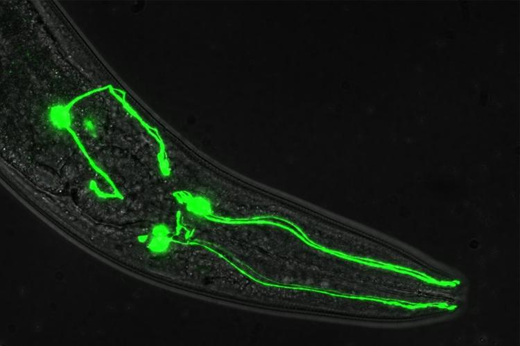 Dopamine-Linked Brain Disorders